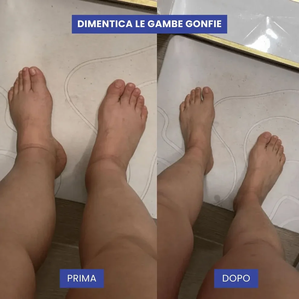 prima_dopo_1